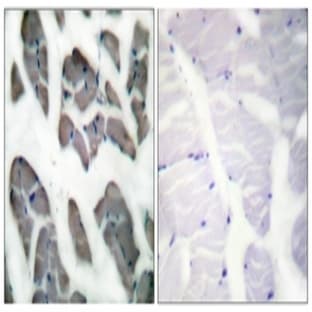anti-Actin, gamma 2, Smooth Muscle, Enteric (ACTG2) antibody avatar