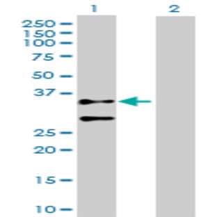 anti-Actin, gamma 2, Smooth Muscle, Enteric (ACTG2) (AA 1-376) antibody avatar