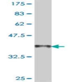 anti-Actin, gamma 2, Smooth Muscle, Enteric (ACTG2) (AA 1-100) antibody avatar