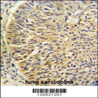 anti-Chaperonin Containing TCP1, Subunit 3 (Gamma) (CCT3) (AA 298-326), (Center) antibody