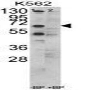 anti-Chaperonin Containing TCP1, Subunit 3 (Gamma) (CCT3) (C-Term) antibody