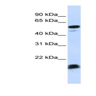 anti-Complement Component 4 Binding Protein, alpha (C4BPA) (Middle Region) antibody avatar