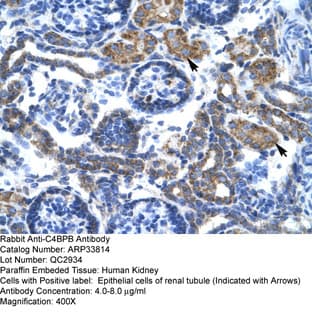 anti-Complement Component 4 Binding Protein, beta (C4BPB) (N-Term) antibody avatar