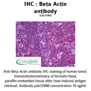 anti-Actin, beta (ACTB) (AA 359-368) antibody avatar