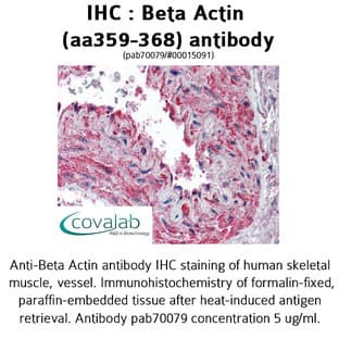anti-Actin, beta (ACTB) (AA 359-368) antibody avatar