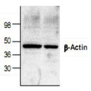 anti-Actin, beta (ACTB) antibody avatar