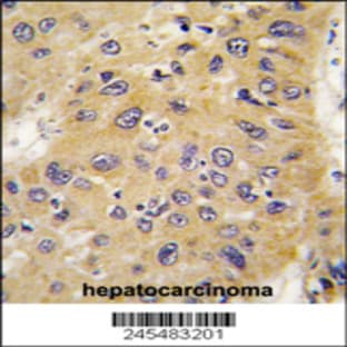 anti-Actin, beta (ACTB) antibody avatar