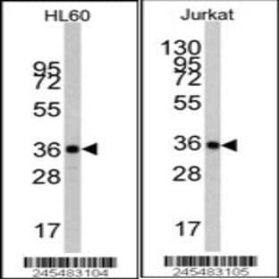 anti-Actin, beta (ACTB) antibody avatar