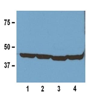 anti-Actin, beta (ACTB) antibody avatar