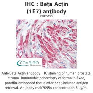 anti-Actin, beta (ACTB) (AA 1-376) antibody avatar