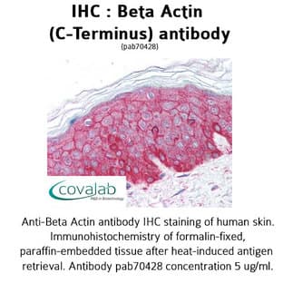 anti-Actin, beta (ACTB) (C-Term) antibody avatar