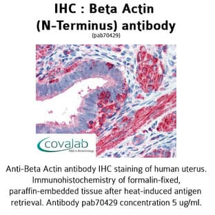 anti-Actin, beta (ACTB) (N-Term) antibody avatar