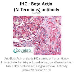 anti-Actin, beta (ACTB) (N-Term) antibody avatar