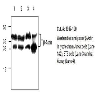 anti-Actin, beta (ACTB) antibody avatar