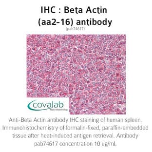 anti-Actin, beta (ACTB) (AA 2-16) antibody avatar