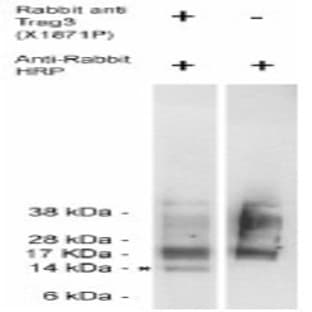 anti-CSAG Family, Member 2 (CSAG2) antibody avatar