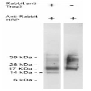 anti-CSAG Family, Member 2 (CSAG2) antibody avatar