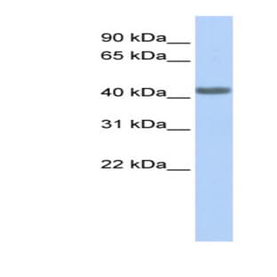 anti-Chemokine (C-C Motif) Receptor 2 (CCR2) (Middle Region) antibody avatar