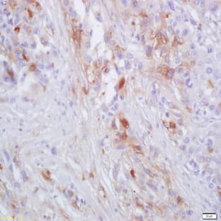 anti-Chemokine (C-C Motif) Receptor 2 (CCR2) antibody avatar