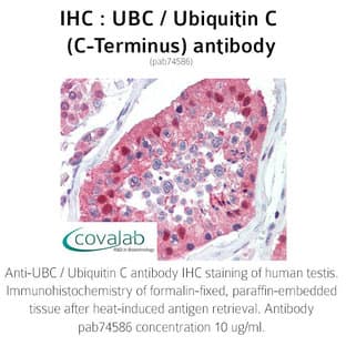 anti-Ubiquitin C (UBC) (C-Term) antibody avatar