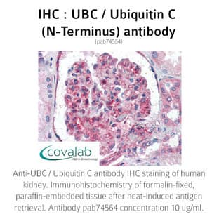 anti-Ubiquitin C (UBC) (N-Term) antibody avatar