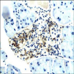 anti-Adiponectin Receptor 1 (ADIPOR1) (Middle Region) antibody avatar