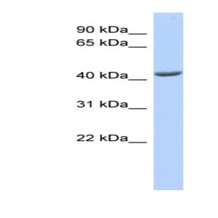 anti-ST3 beta-Galactoside alpha-2,3-Sialyltransferase 4 (ST3GAL4) (Middle Region) antibody