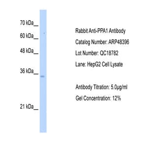 anti-Pyrophosphatase (Inorganic) 1 (PPA1) (N-Term) antibody avatar