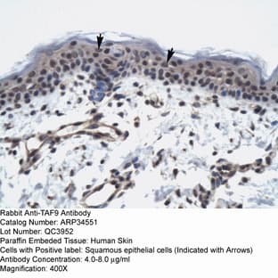 anti-RNA Polymerase II TBP-Associated Factor Subunit G (TAF9) (N-Term) antibody avatar