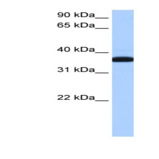 anti-Exoribonuclease 1 (ERI1) (N-Term) antibody avatar