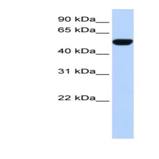 anti-BTB (POZ) Domain Containing 10 (BTBD10) (N-Term) antibody avatar