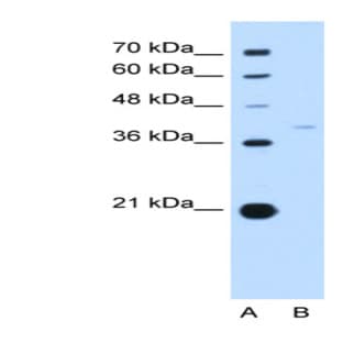 anti-Replication Factor C (Activator 1) 3, 38kDa (RFC3) (N-Term) antibody avatar