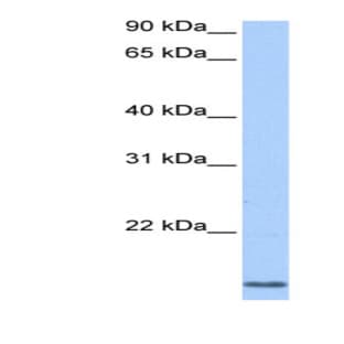 anti-Cyclin L2 (CCNL2) (N-Term) antibody avatar