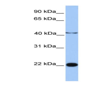 anti-Chromosome 2 Open Reading Frame 68 (C2orf68) (N-Term) antibody avatar