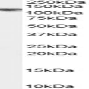 anti-Cylindromatosis (Turban Tumor Syndrome) (CYLD) (Internal Region) antibody avatar
