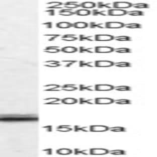 anti-Von Hippel-Lindau Tumor Suppressor, E3 Ubiquitin Protein Ligase (VHL) (Internal Region) antibody