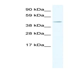 anti-TAF7-Like RNA Polymerase II, TATA Box Binding Protein (TBP)-Associated Factor, 50kDa (TAF7L) (Middle Region) antibody