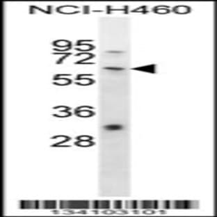 anti-Wolf-Hirschhorn Syndrome Candidate 2 (WHSC2) (AA 251-279), (Center) antibody