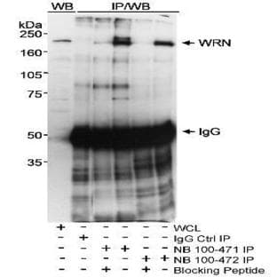 anti-RECQL2 (ARABIDOPSIS RECQ HELICASE L2), 3'-5' DNA Helicase/ ATP-Dependent Helicase/ Four-Way Junction Helicase/ Protein Binding (RECQL2) antibody