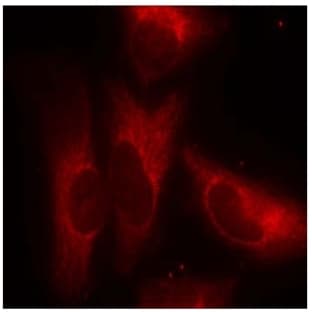 anti-tyrosine 3-Monooxygenase/tryptophan 5-Monooxygenase Activation Protein, zeta Polypeptide (YWHAZ) (pSer58) antibody