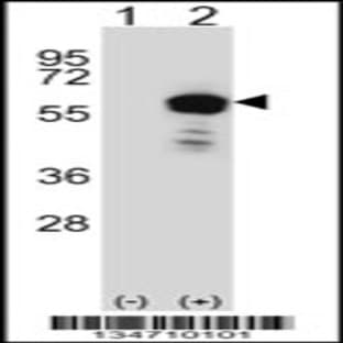 anti-zeta-Chain (TCR) Associated Protein Kinase 70kDa (ZAP70) (AA 276-304), (Center) antibody
