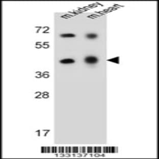 anti-Adenosine Deaminase-Like Protein (ADAL) (C-Term), (AA 317-344) antibody avatar
