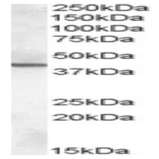 anti-Abhydrolase Domain Containing 12 (ABHD12) (C-Term) antibody avatar