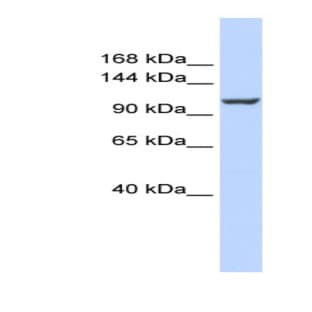 anti-ATPase, Ca++ Transporting, Plasma Membrane 4 (ATP2B4) (Middle Region) antibody avatar