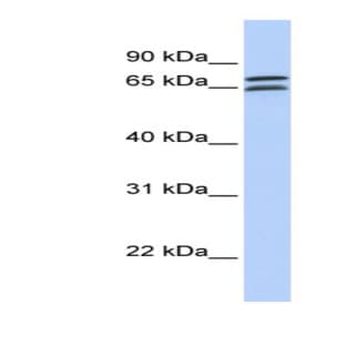 anti-DCP1 Decapping Enzyme Homolog B (S. Cerevisiae) (DCP1B) (N-Term) antibody avatar