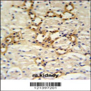 anti-Bartter Syndrome, Infantile, with Sensorineural Deafness (Barttin) (BSND) (C-Term), (AA 292-320) antibody