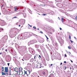 anti-Chemokine (C-X-C Motif) Receptor 4 (CXCR4) (Cytoplasmic Domain) antibody avatar