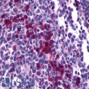 anti-Chemokine (C-X-C Motif) Receptor 4 (CXCR4) (Cytoplasmic Domain) antibody avatar
