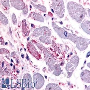 anti-Chemokine (C-X-C Motif) Receptor 4 (CXCR4) (C-Term) antibody avatar