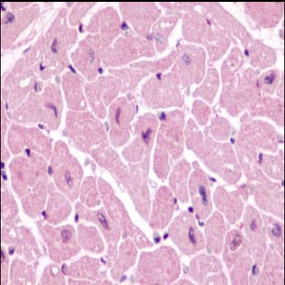 anti-Chemokine (C-X-C Motif) Receptor 4 (CXCR4) (N-Term) antibody avatar